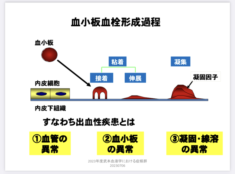 出血傾向を調べる際に行われる 通信 | 出血・出血傾向に関するQ&A – WNCK